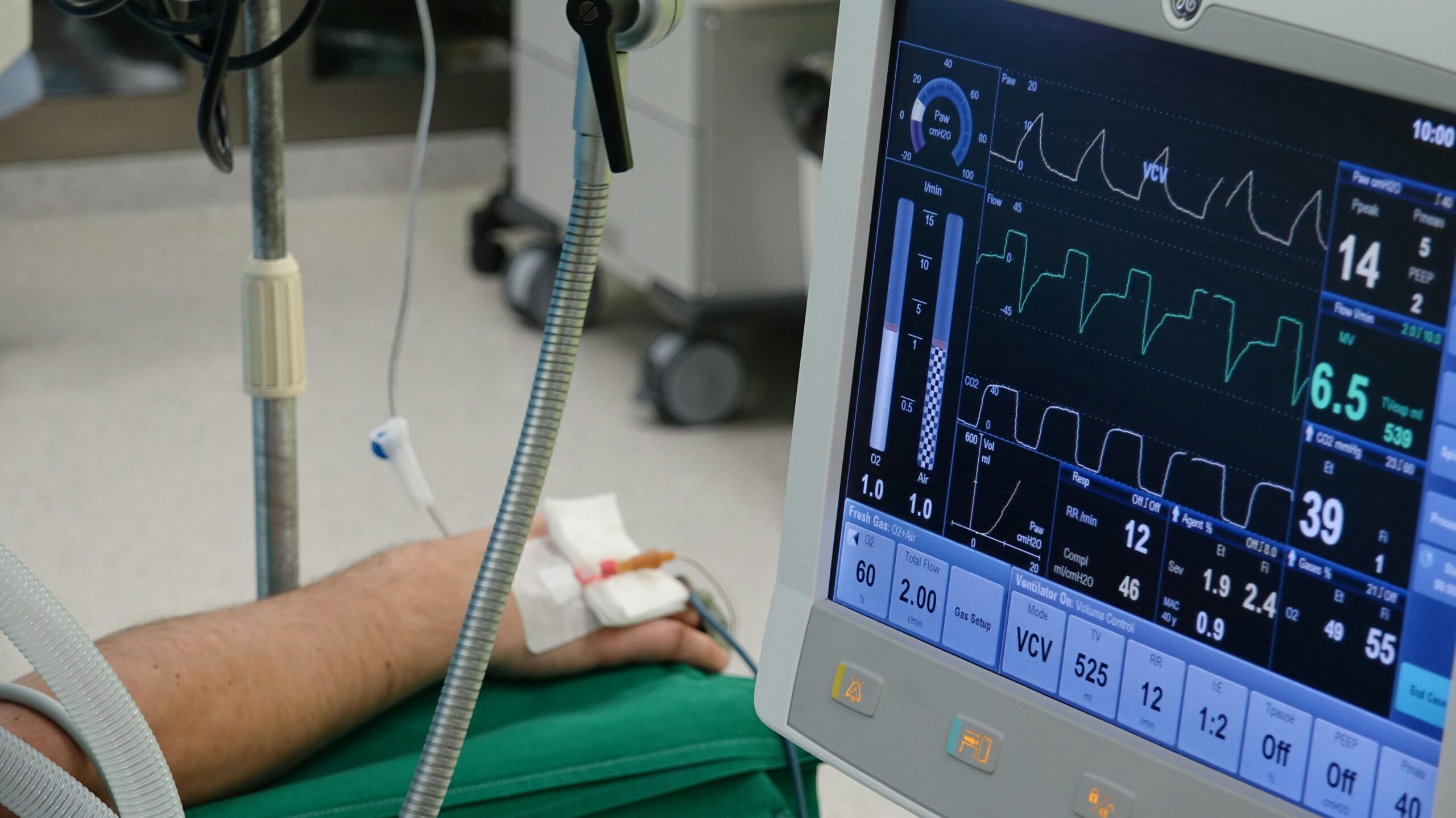 A close-up of a patient's hand connected to medical equipment in an ICU room.